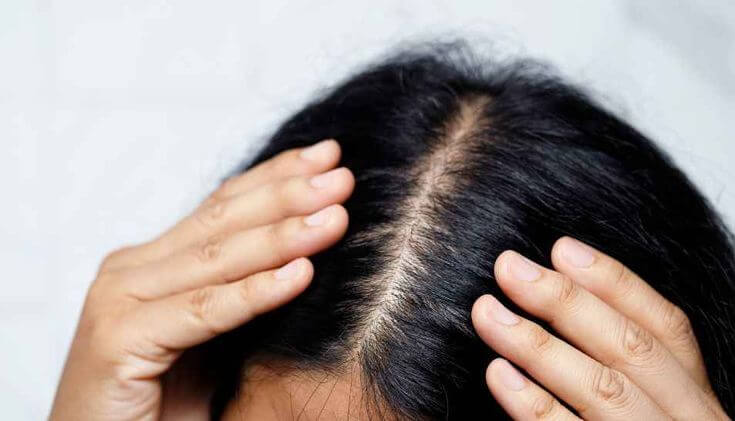 Here is the Right Way of Treating a Sensitive Scalp