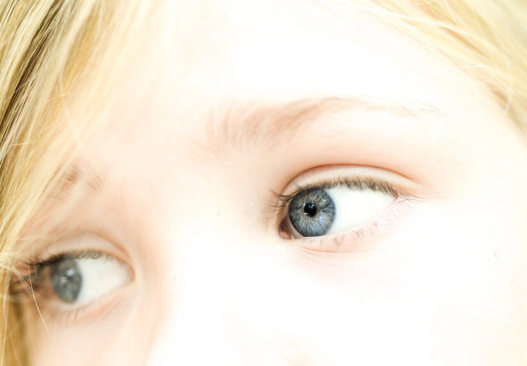 Get Rid Of Dark Circles under Your Eyes with Eye Cream
