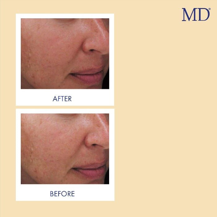 MD Factor Vitamin C Face Serum - Anti-Aging Face Serum with Vitamin C  - 1 fl oz e/ 30ml - MD