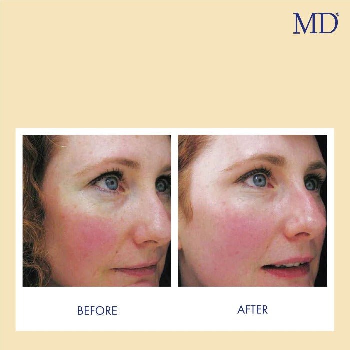MD Factor Vitamin C Face Serum - Anti-Aging Face Serum with Vitamin C  - 1 fl oz e/ 30ml - MD