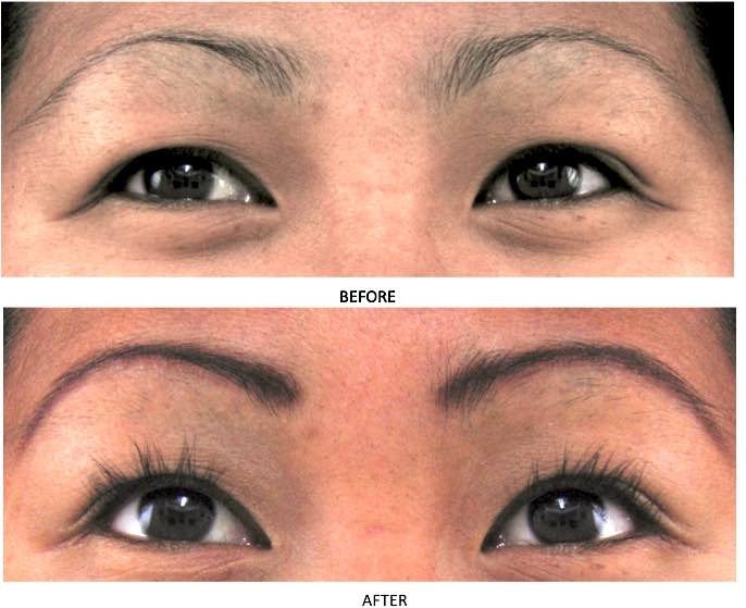 Before and after of young Asian woman showing impressive lash length increase after 4 weeks of MD Lash Factor 6-month use